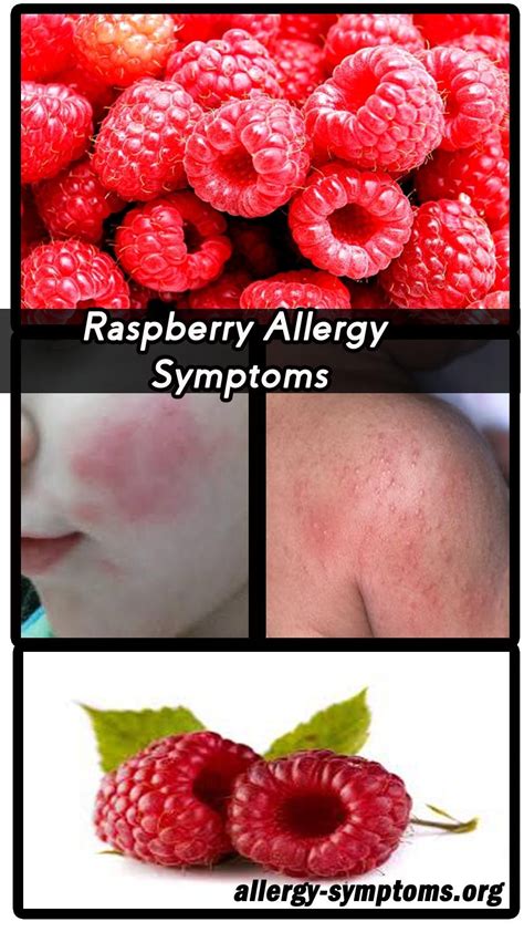 berry allergy